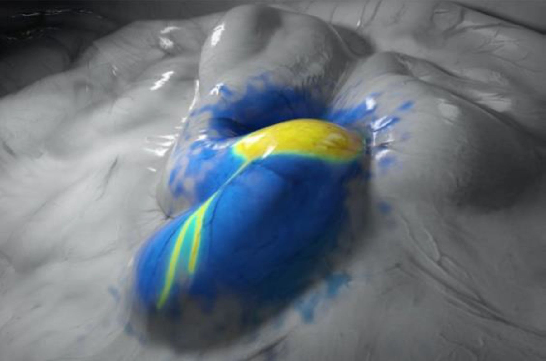 FI blanc – Technologie d’imagerie par fluorescence 3D