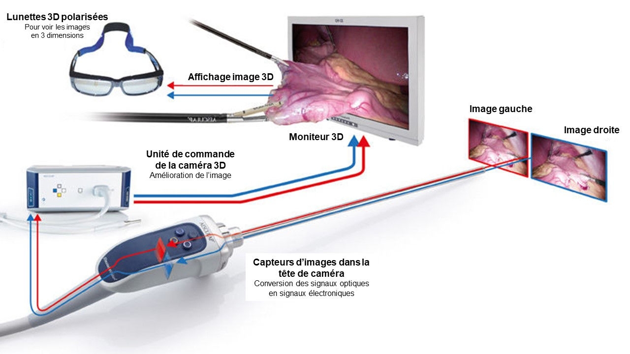 schema en savoir plus sur la 3D – Comment fonctionne la 3D ?