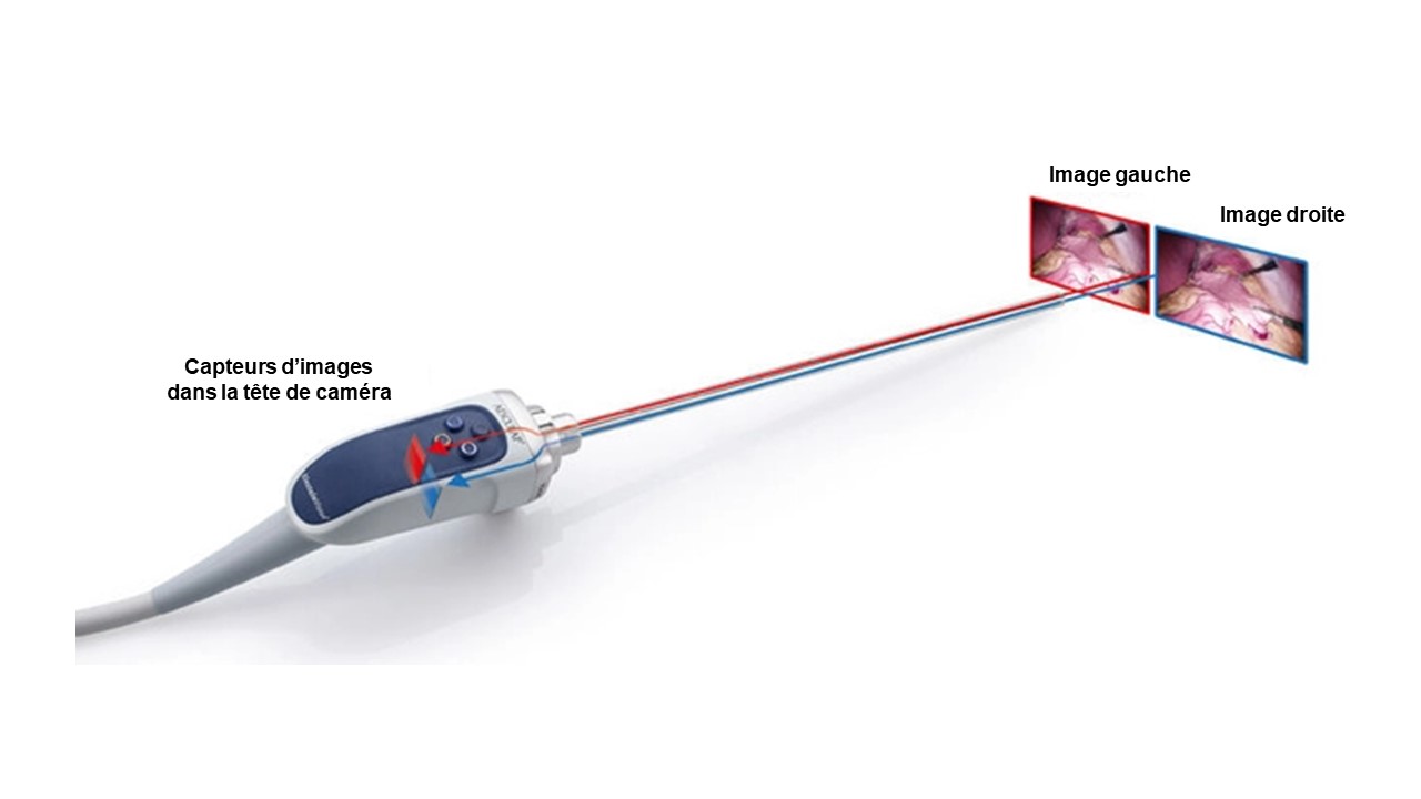 Exemple d’un système de caméra 3D classique comme le système 3D EinsteinVision®