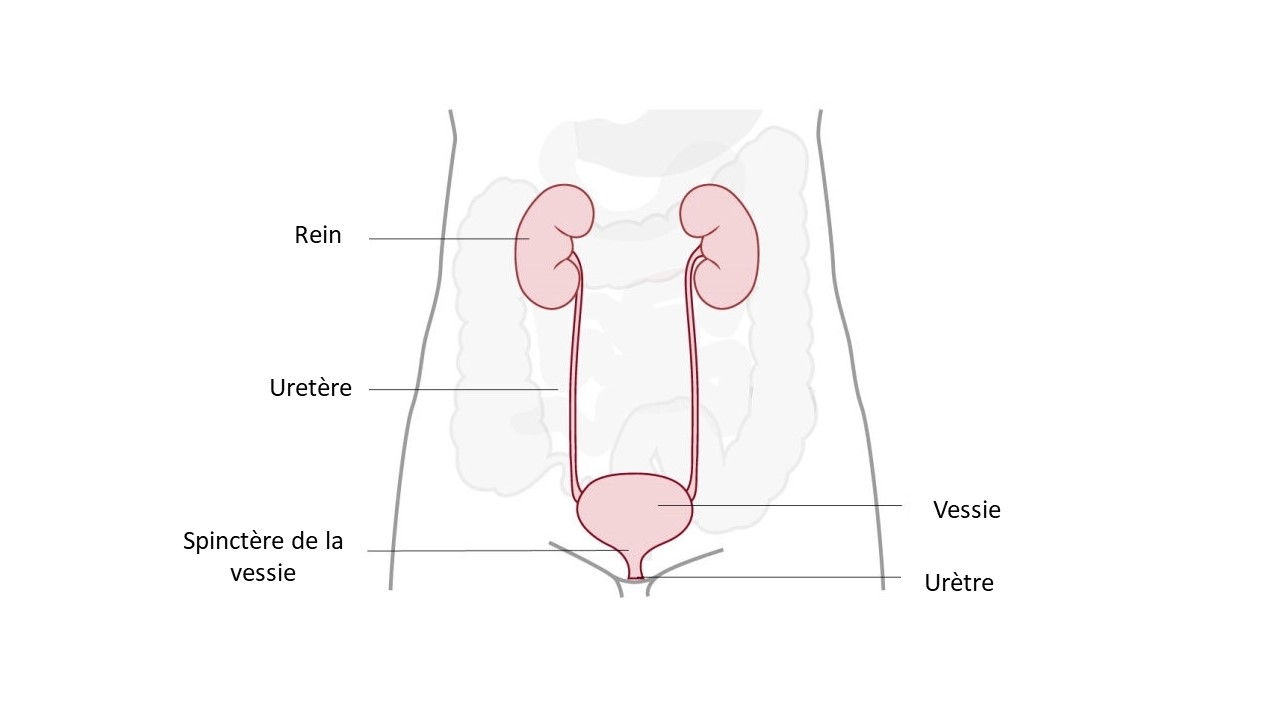 illustration de l’urostomie